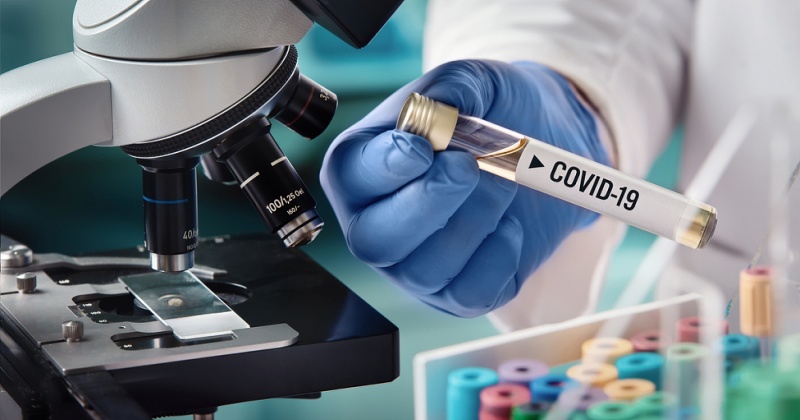 Тесты на коронавирус больше не надо отправлять в «Вектор» из Магадана