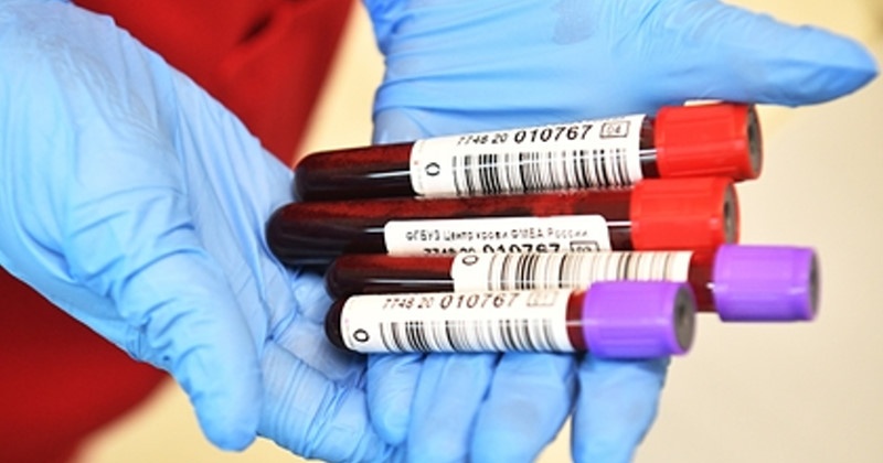 Пять новых случаев заражения коронавирусом за сутки в Магадане и регионе