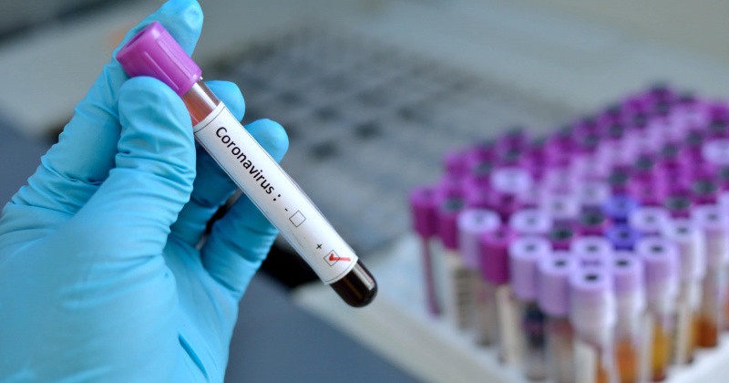 За сутки в Магадане и регионе зарегистрирован восемь  новых случаев заражения коронавирусом